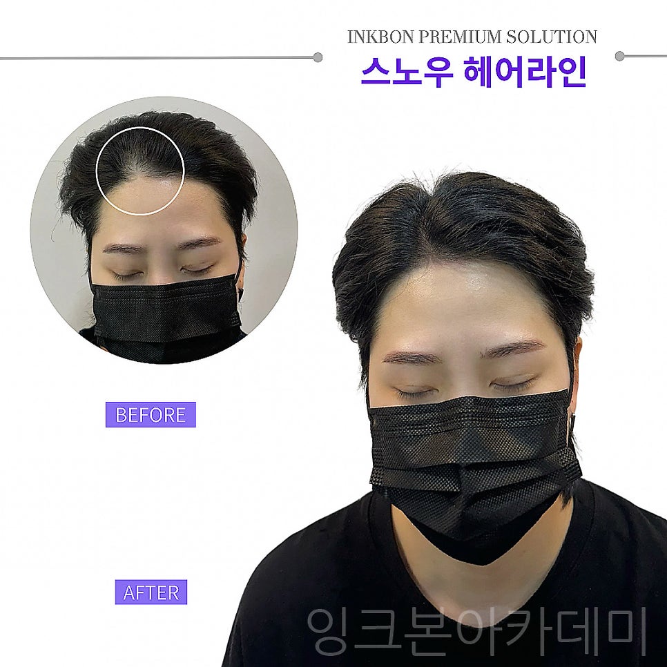 두피문신 작업