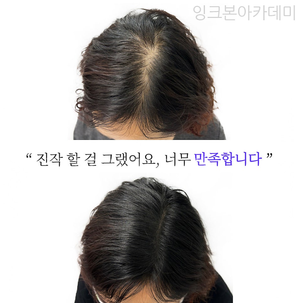 두피문신 작업