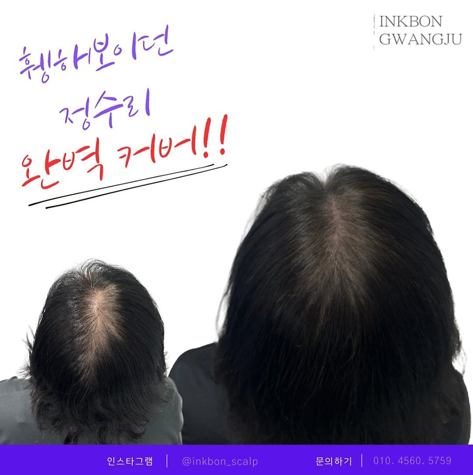 두피문신 작업